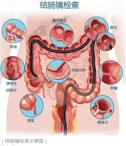 竹溪县人民医院太和医疗集团竹溪分院消化内科专家超全讲解胃镜肠镜