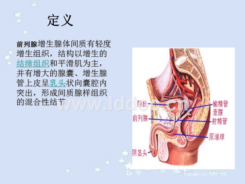 [谈医论症]中青年男性:发现前列腺增生怎么办?