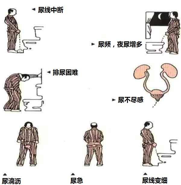 男性尿道症状图片